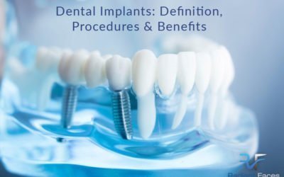 Dental Implants: Definition, Procedures, and Benefits – Bristol UK